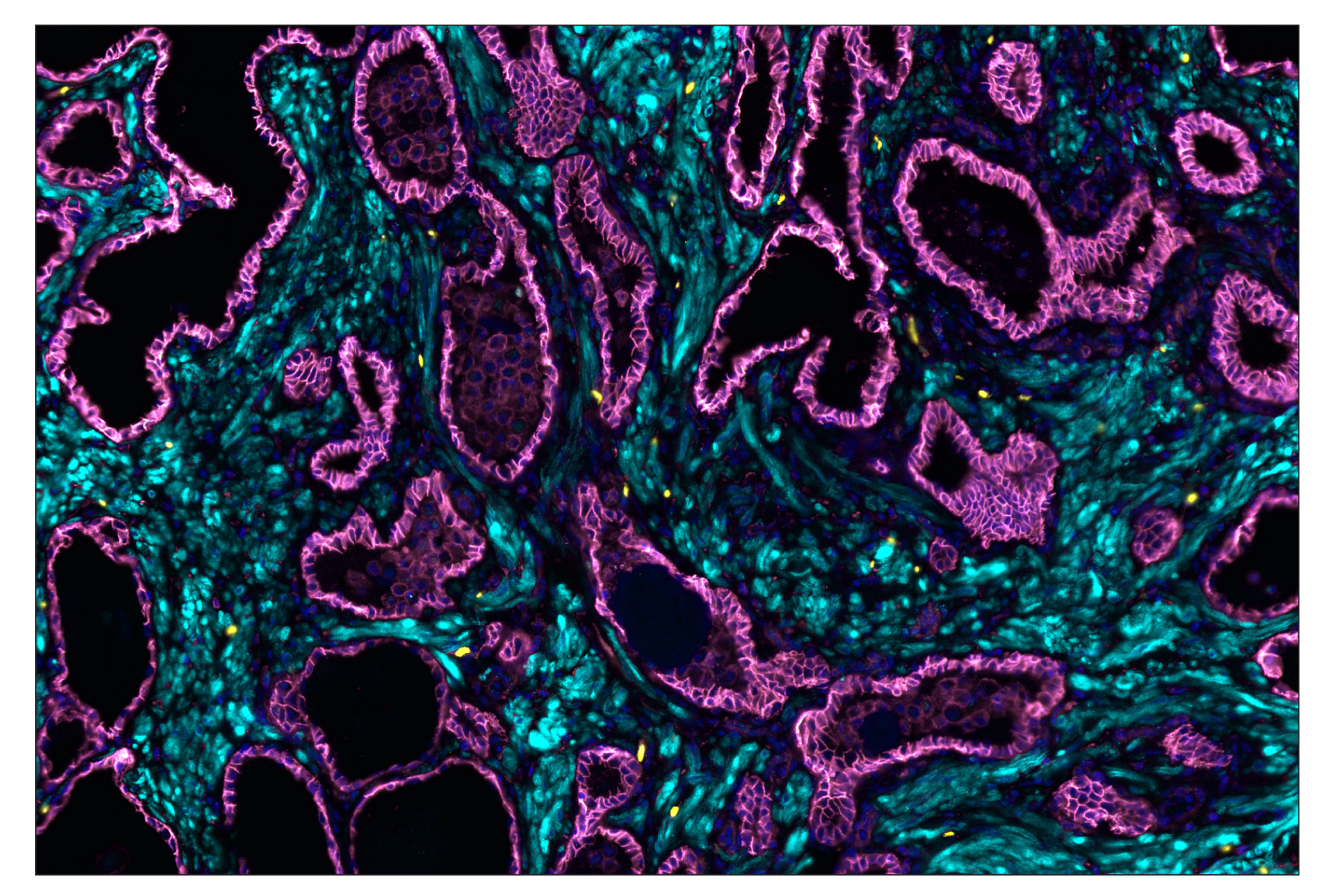 Immunohistochemistry Image 1: Sox10 (E6B6I) & CO-0080-594 SignalStar™ Oligo-Antibody Pair