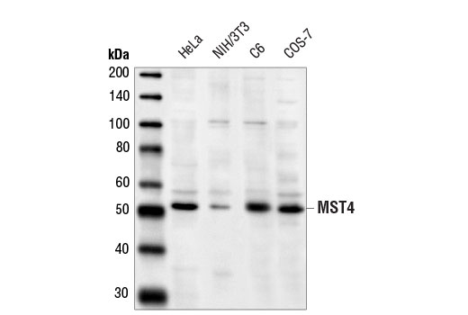 Western Blotting Image 1: MST4 Antibody
