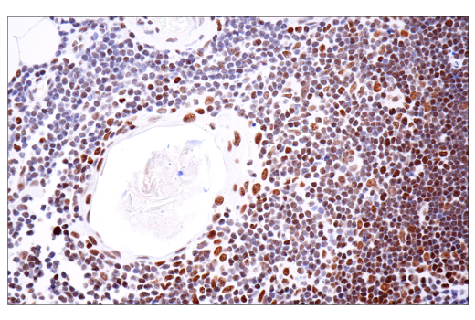 Immunohistochemistry Image 10: PBRM1/BAF180 (D4L9X) Rabbit mAb