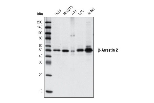 Western Blotting Image 1: β-Arrestin 2 (C16D9) Rabbit mAb