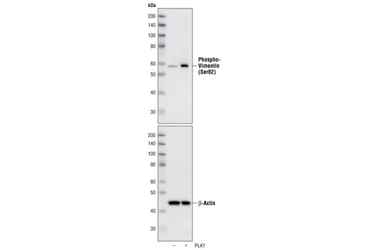 Western Blotting Image 1: Phospho-Vimentin (Ser83) Antibody
