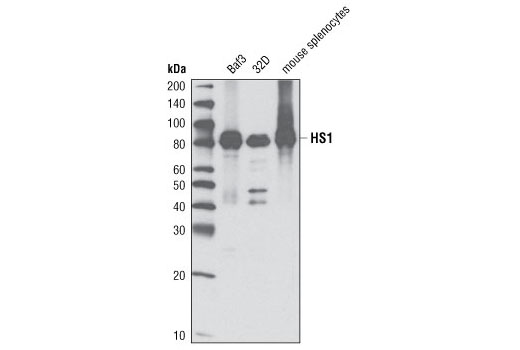  Image 8: β-Amyloid Mouse Model Neuronal Viability IF Antibody Sampler Kit
