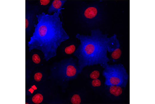 Immunofluorescence Image 1: DYKDDDDK Tag Antibody (Binds to same epitope as Sigma's Anti-FLAG® M2 Antibody) (Alexa Fluor® 647 Conjugate)