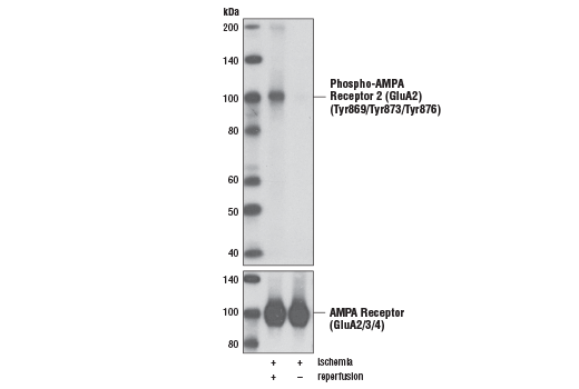  Image 5: AMPA Receptor (GluA) Antibody Sampler Kit
