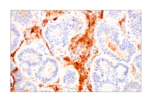  Image 40: Late-Onset Alzheimer's Disease Risk Gene Antibody Sampler Kit