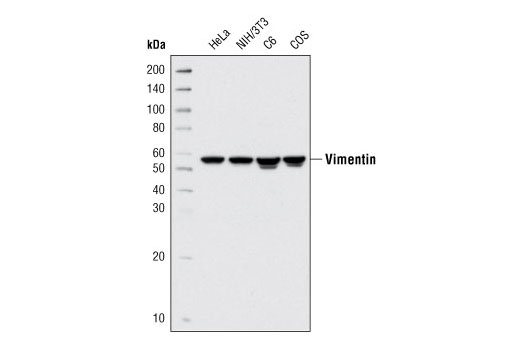 Western Blotting Image 2: Vimentin (R28) Antibody