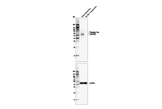  Image 7: Phospho-Tau Family Antibody Sampler Kit