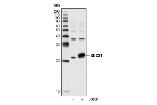 Western Blotting Image 2: SOCS1 (A156) Antibody