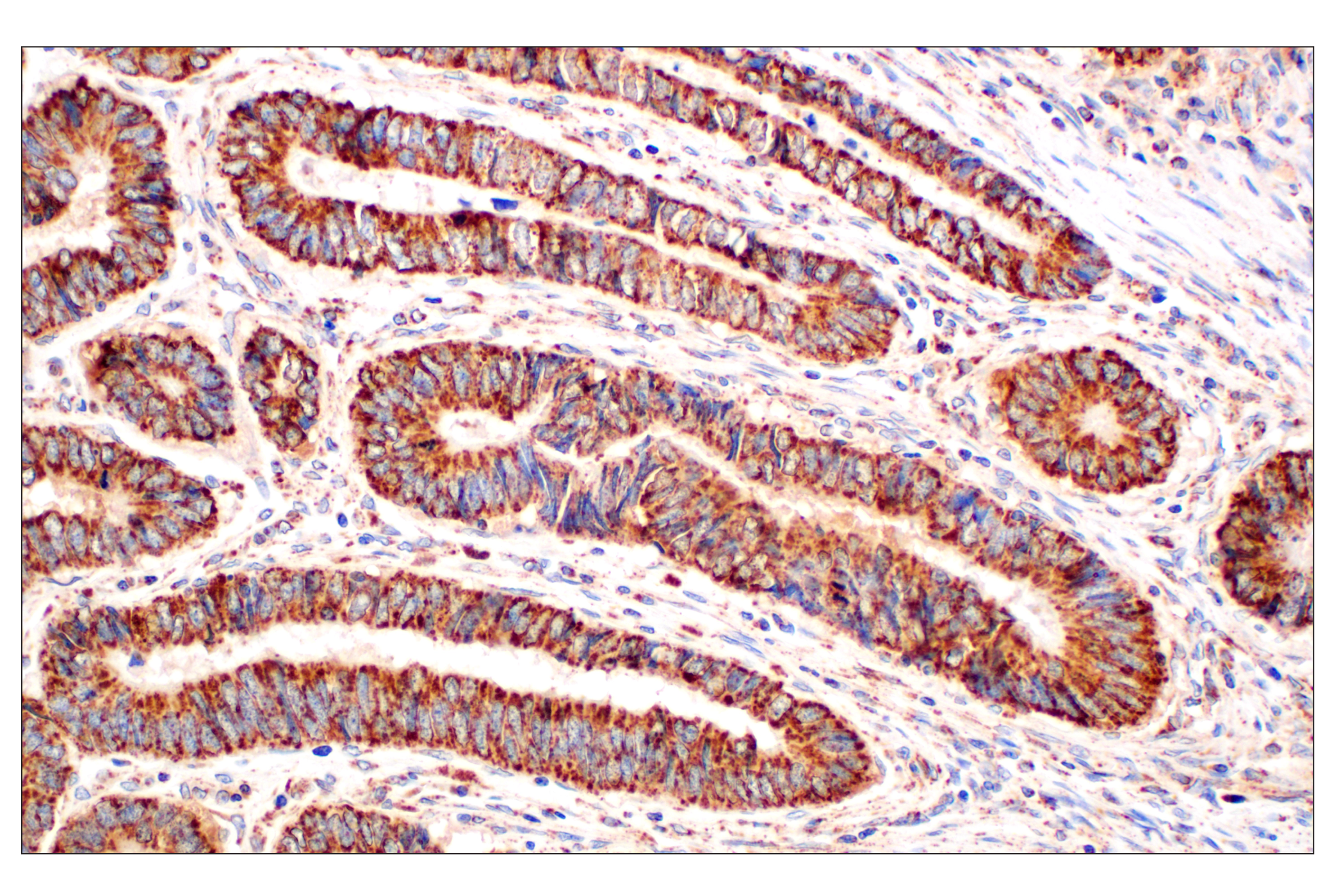Immunohistochemistry Image 1: GOT2 (F4P3R) Rabbit mAb