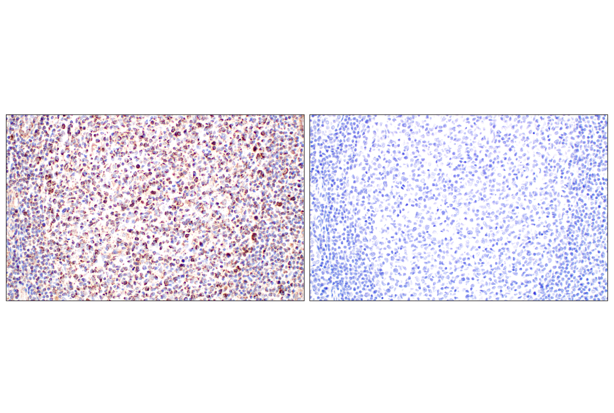 Immunohistochemistry Image 13: GOT2 (F4P3R) Rabbit mAb