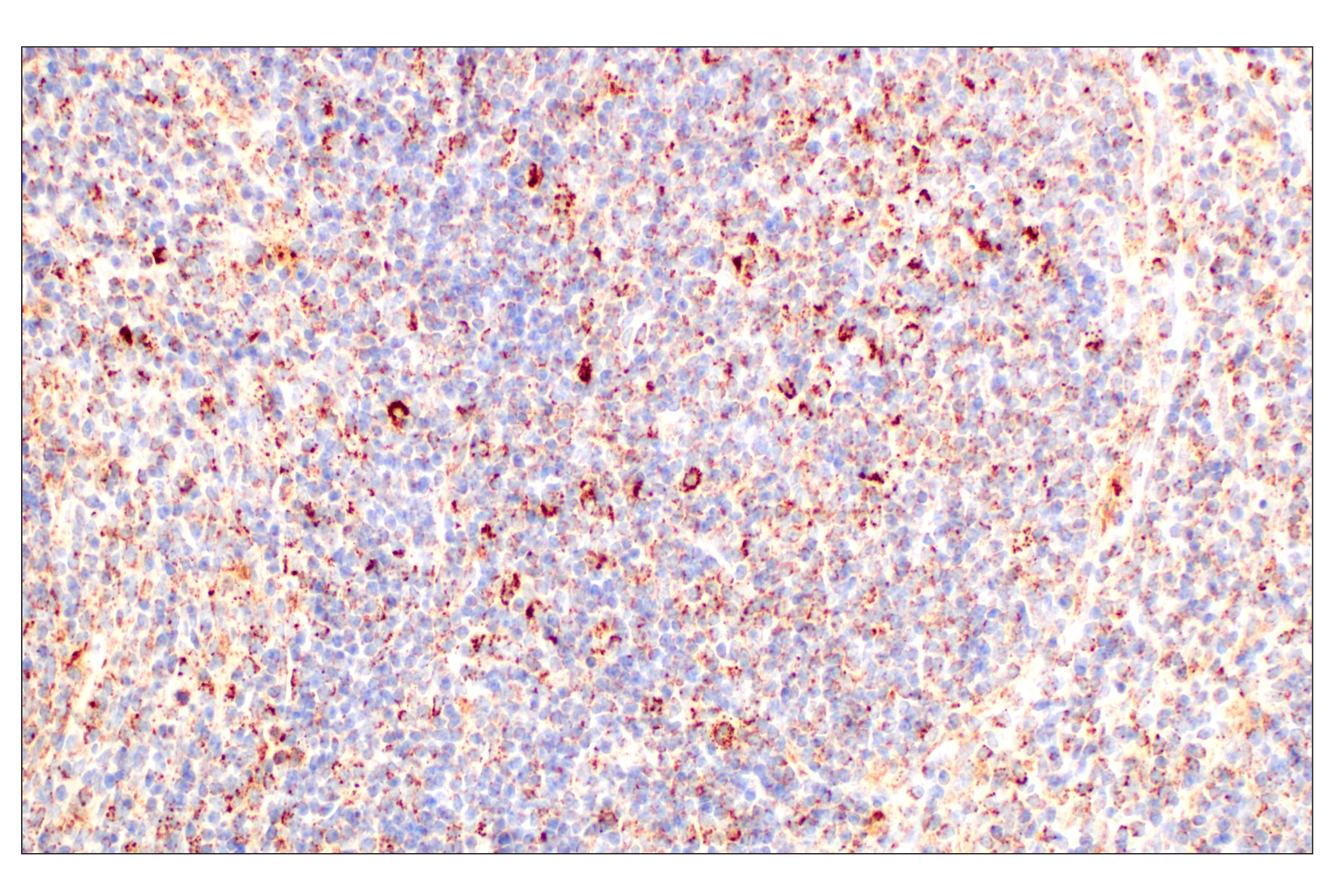Immunohistochemistry Image 12: GOT2 (F4P3R) Rabbit mAb