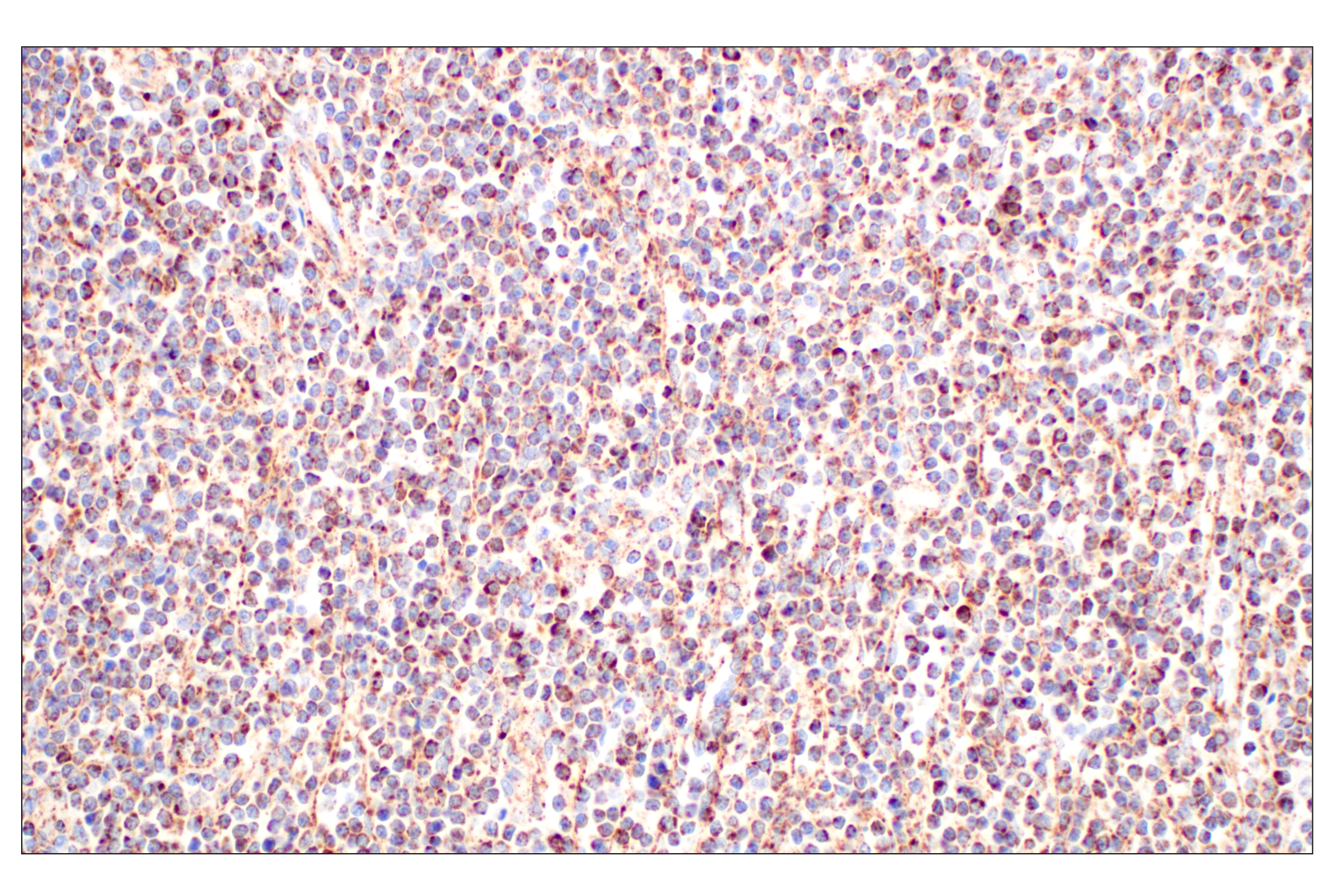 Immunohistochemistry Image 2: GOT2 (F4P3R) Rabbit mAb