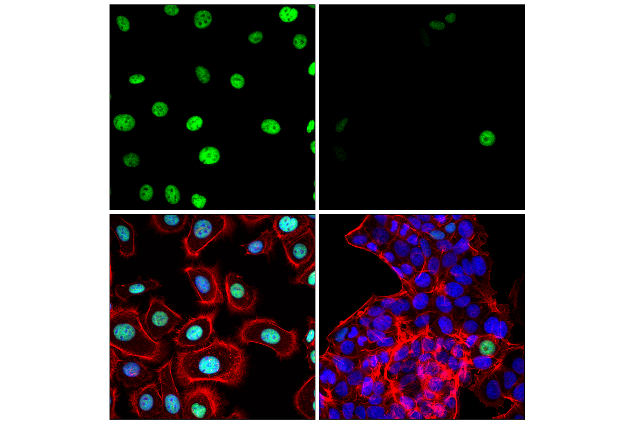 Immunofluorescence Image 1: p63 (D9L7L) XP® Rabbit mAb