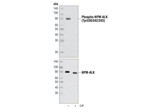  Image 6: ALK Antibody Sampler Kit