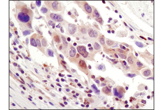 Immunohistochemistry Image 1: NF-κB p65 (E498) Antibody