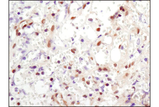 Immunohistochemistry Image 2: NF-κB p65 (E498) Antibody