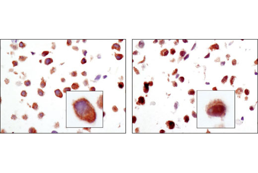 Immunohistochemistry Image 4: NF-κB p65 (E498) Antibody