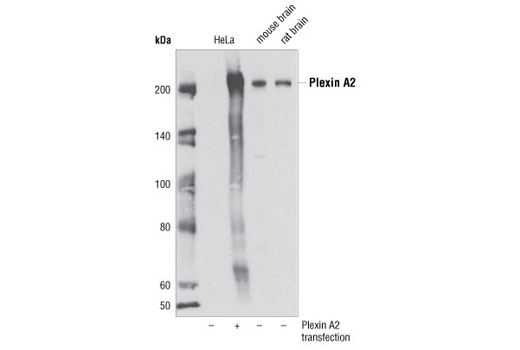 Western Blotting Image 1: Plexin A2 Antibody