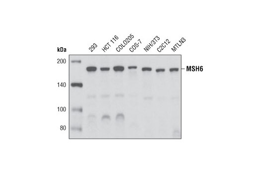 Western Blotting Image 1: MSH6 (P150) Antibody
