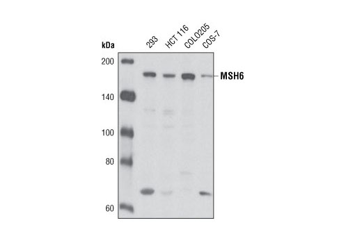 Western Blotting Image 1: MSH6 (L990) Antibody