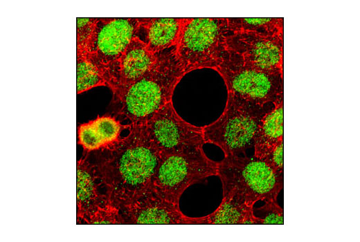 Immunofluorescence Image 1: MSH6 (L990) Antibody
