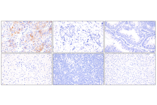 Immunohistochemistry Image 3: AFP (C3) Mouse mAb