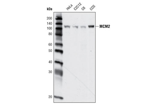 Western Blotting Image 1: MCM2 Antibody