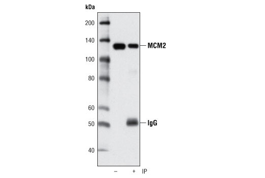 Immunoprecipitation Image 1: MCM2 Antibody