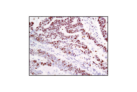 Immunohistochemistry Image 1: MCM2 Antibody