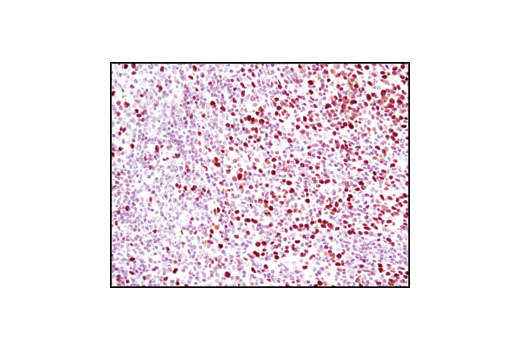 Immunohistochemistry Image 2: MCM2 Antibody