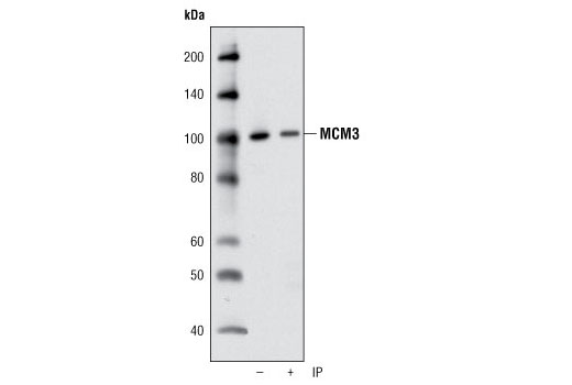 Immunoprecipitation Image 1: MCM3 Antibody