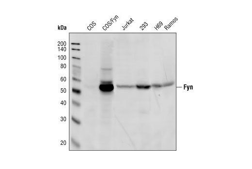 Western Blotting Image 1: Fyn Antibody