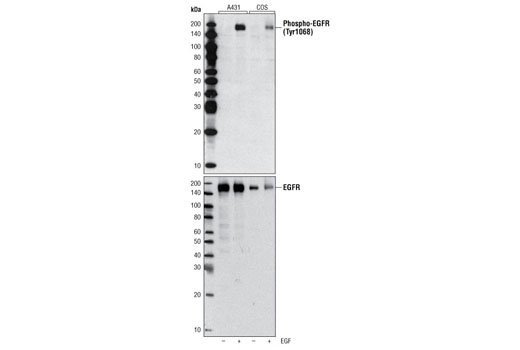 Western Blotting Image 1: Phospho-EGF Receptor (Tyr1068) (1H12) Mouse mAb (Biotinylated)