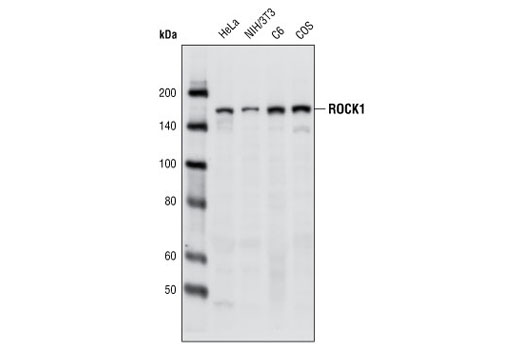  Image 6: Cofilin Activation Antibody Sampler Kit
