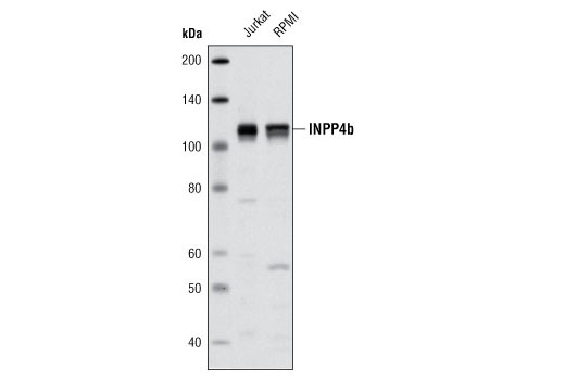 Western Blotting Image 1: INPP4b Antibody