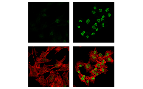 Immunofluorescence Image 1: XBP-1s (E9V3E) Rabbit mAb