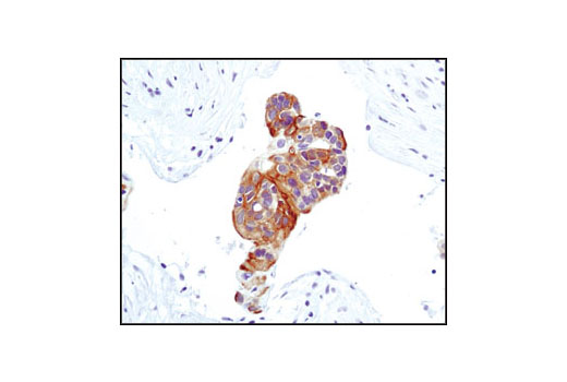 Immunohistochemistry Image 5: Phospho-Akt (Ser473) (D9E) XP® Rabbit mAb