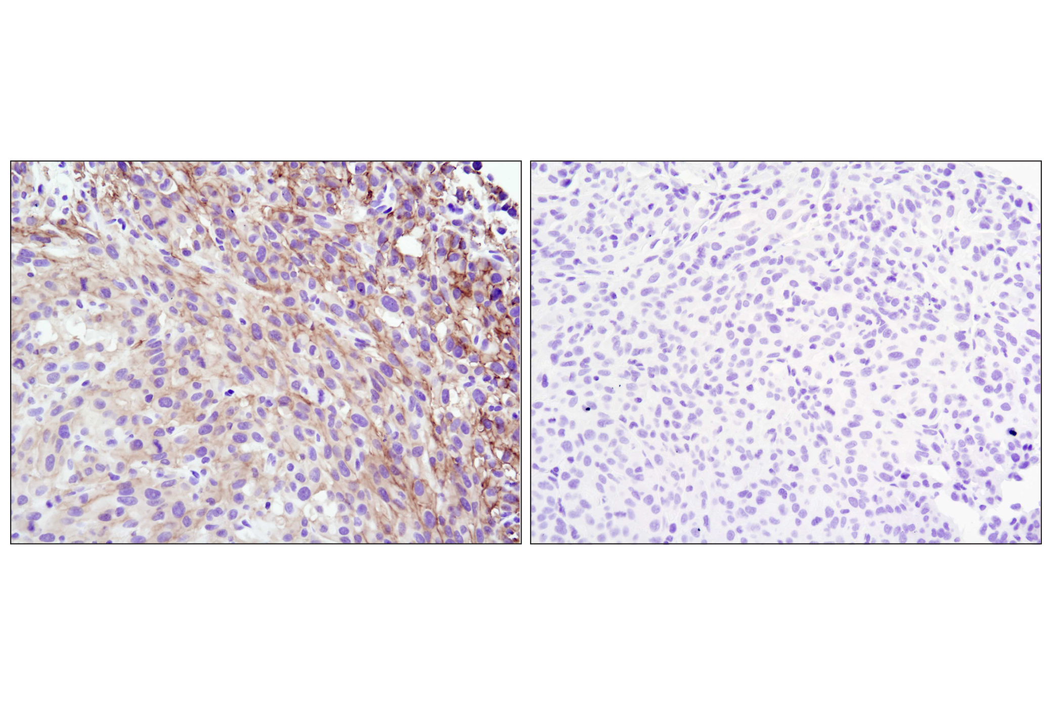  Image 51: Oncogene and Tumor Suppressor Antibody Sampler Kit