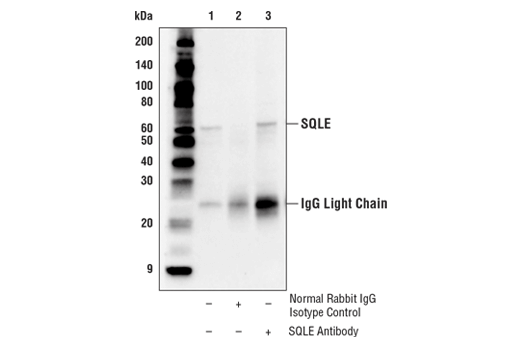 Immunoprecipitation Image 1: SQLE Antibody