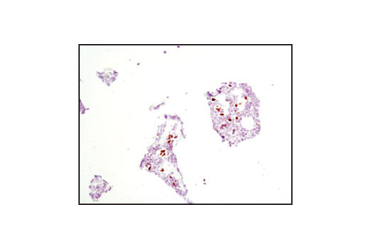 Immunohistochemistry Image 2: GATA-1 (D52H6) XP® Rabbit mAb (BSA and Azide Free)