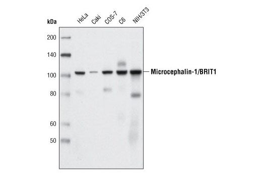 Western Blotting Image 1: Microcephalin-1/BRIT1 (D38G5) Rabbit mAb