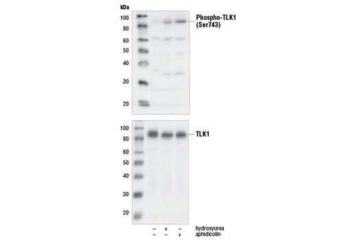 Western Blotting Image 1: Phospho-TLK1 (Ser743) Antibody