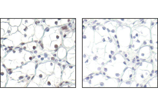 Immunohistochemistry Image 2: Phospho-TLK1 (Ser743) Antibody
