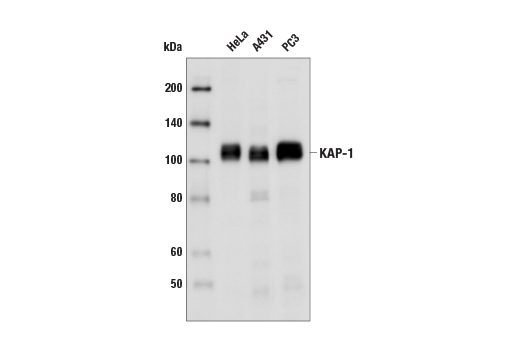 Western Blotting Image 1: KAP-1 Antibody