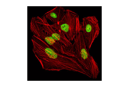 Immunofluorescence Image 1: KAP-1 Antibody