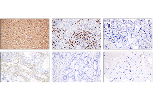 Immunohistochemistry Image 4: Arginase-1 (E4U1I) Mouse mAb (BSA and Azide Free)