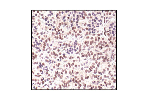Immunohistochemistry Image 2: Phospho-Cyclin E1 (Thr62) Antibody