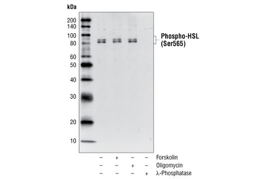  Image 4: Lipolysis Activation Antibody Sampler Kit
