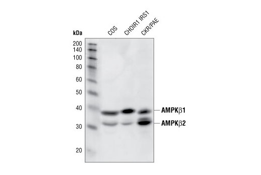  Image 6: AMPK and ACC Antibody Sampler Kit