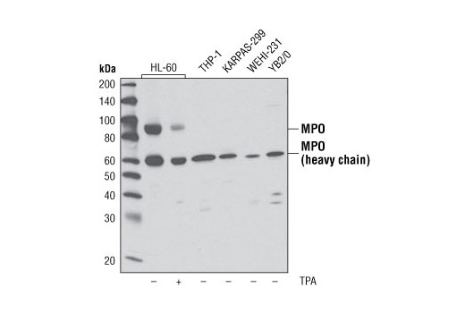 Western Blotting Image 2: Myeloperoxidase (L607) Antibody